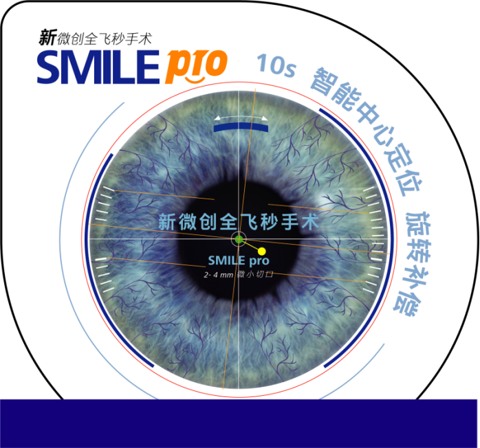 新一代全飛秒Smile pro  超快智能更安全(1)490